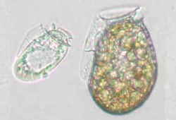 渦鞭毛藻の顕微鏡写真：下痢性貝毒原因渦鞭毛藻／貝毒の原因と症状