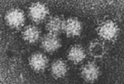 ノロウイルスの電子顕微鏡写真／牡蠣とノロウイルス～怖い食中毒の話