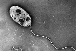 腸炎ビブリオの電子顕微鏡写真／牡蠣とノロウイルス～怖い食中毒の話