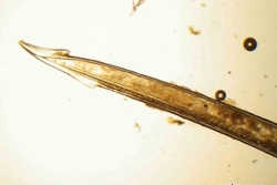 イモガイの毒銛の顕微鏡写真
