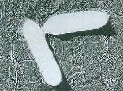 ポツリヌス菌／自然界で最も強い天然毒ランキング