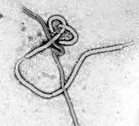 エボラウイルスの顕微鏡写真（ザイールエボラウイルス）／エボラ出血熱のすべて
