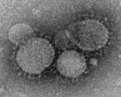 MERSコロナウイルスの電子顕微鏡写真～MERS（マーズ）のすべて｜アウトドア趣味に関する総合情報サイト